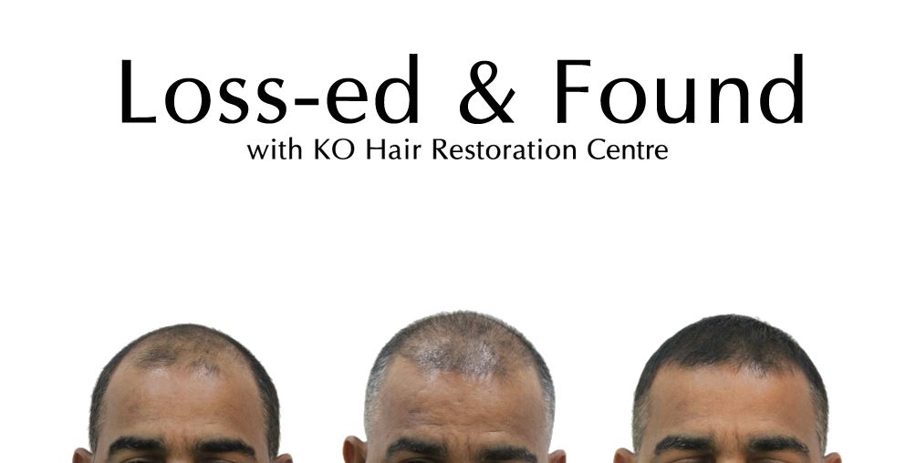 Dr Ko Hair Restoration Centre