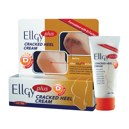 Ellgy Plus D Factor Cracked Heel Cream 