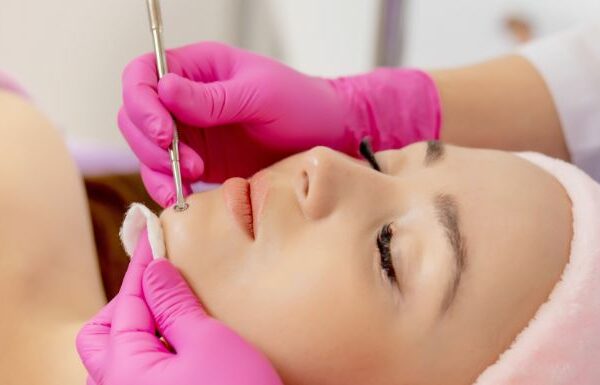 5 Best Acne Treatment Clinics in KL & PJ