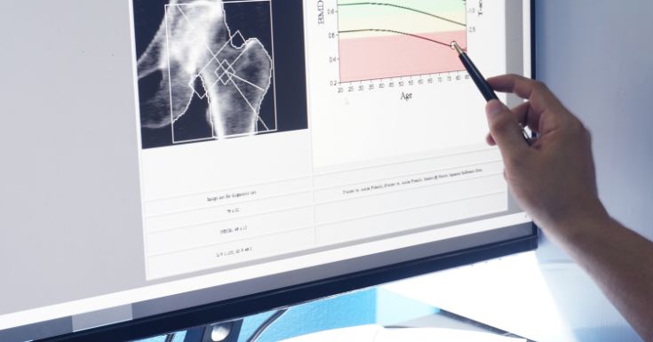 Women health screening - bone density test