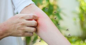 Rainy-Season Home Protection: Which Mosquito-Control Products Work Best in Malaysian Homes?
