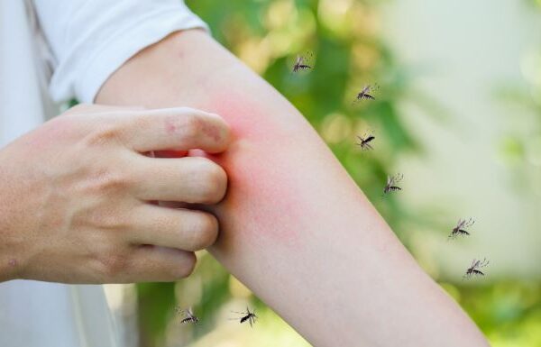 Rainy-Season Home Protection: Which Mosquito-Control Products Work Best in Malaysian Homes?